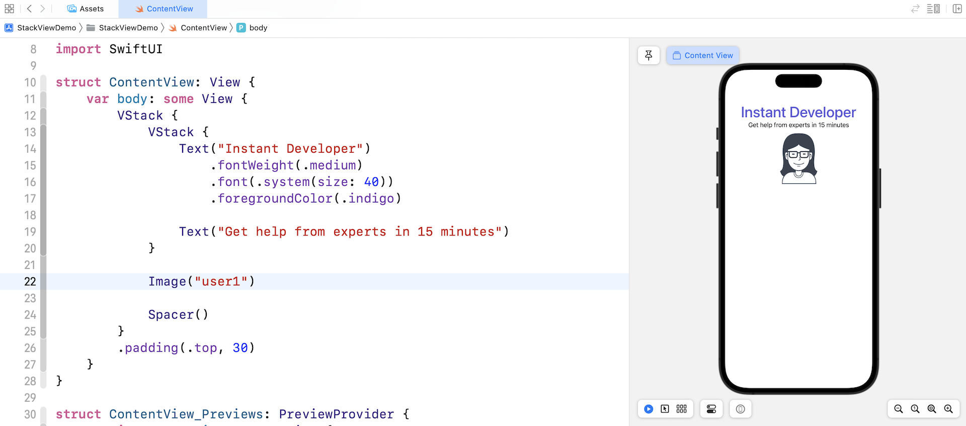 Figure 4-11. Adding an image view for displaying images