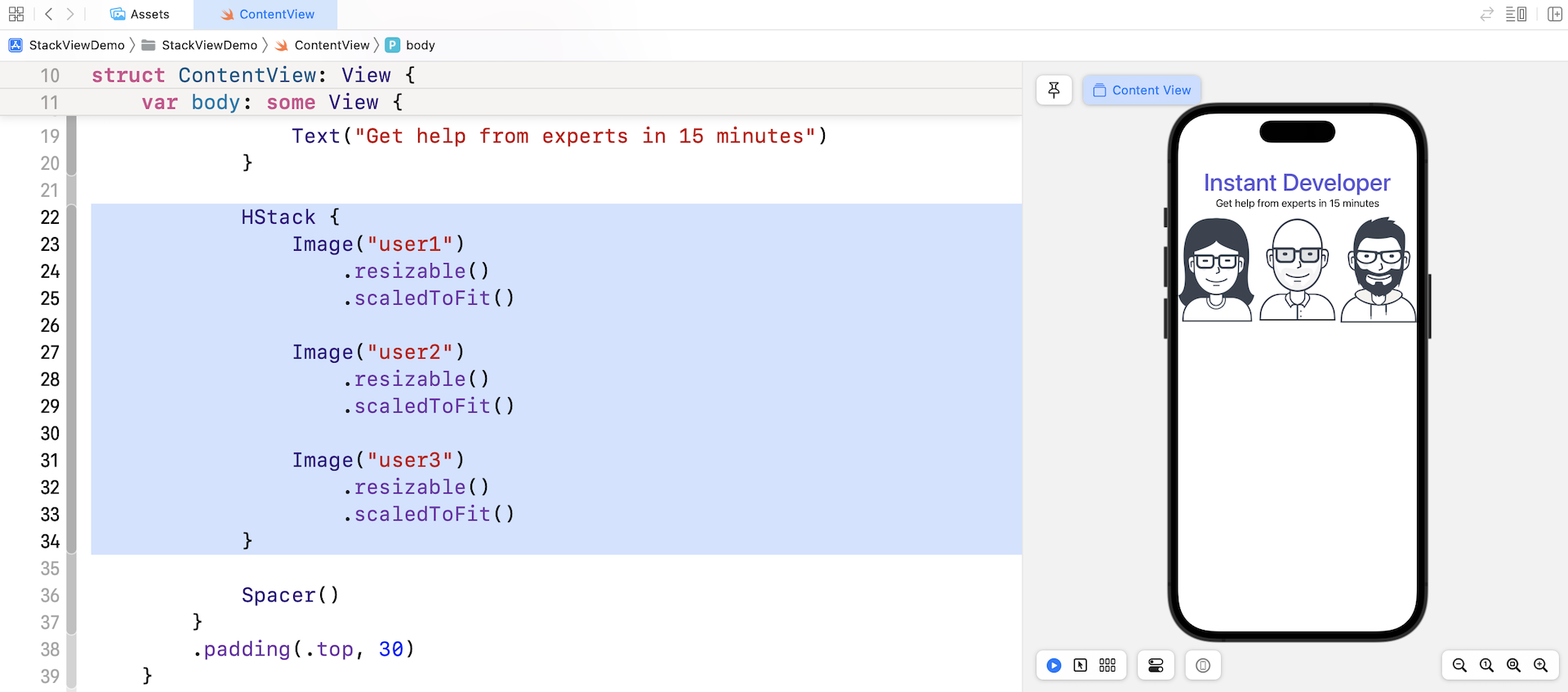 Figure 4-14. Arrange the image views side by side